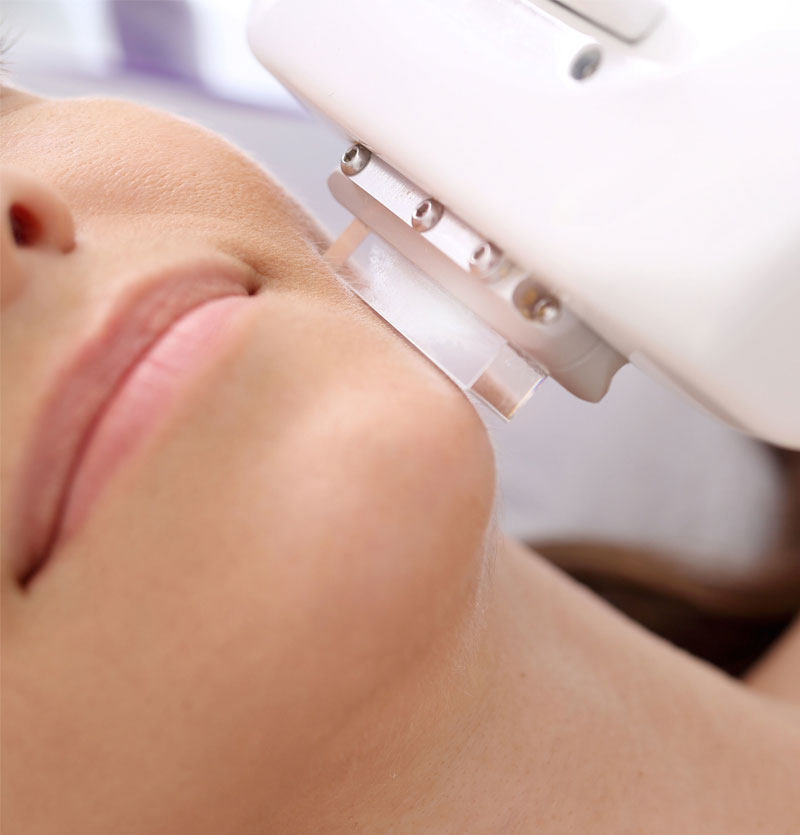 الليزر لتفتيح تصبغات الجلد