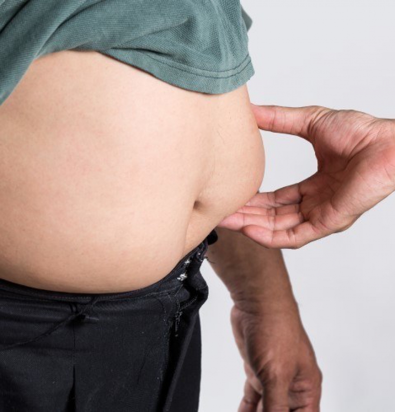 ترهلات البطن